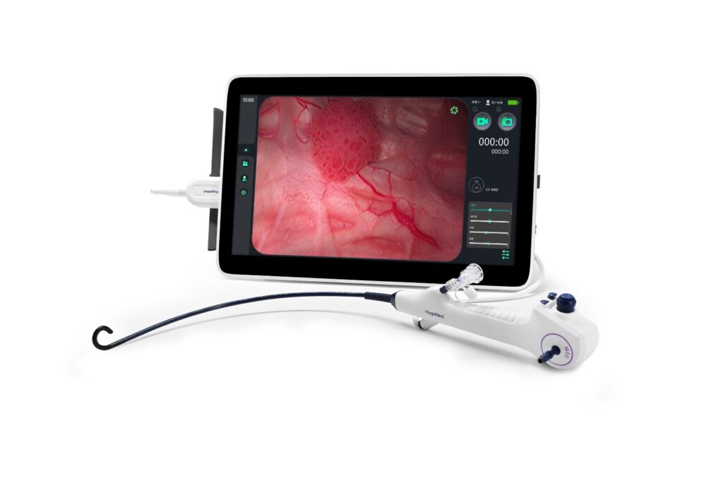 Urological Scopes - PRO ELEMENT TECHNOLOGY